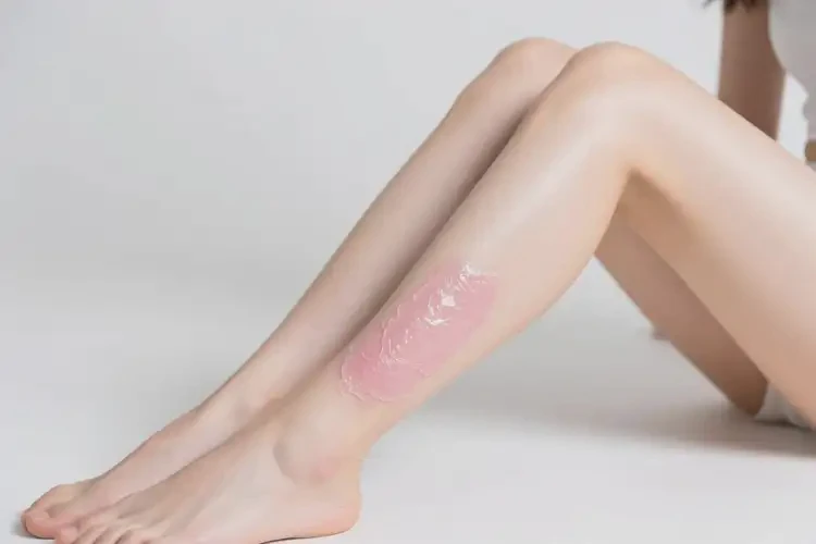 女生小腿出湿疹可不可以根治(图3)