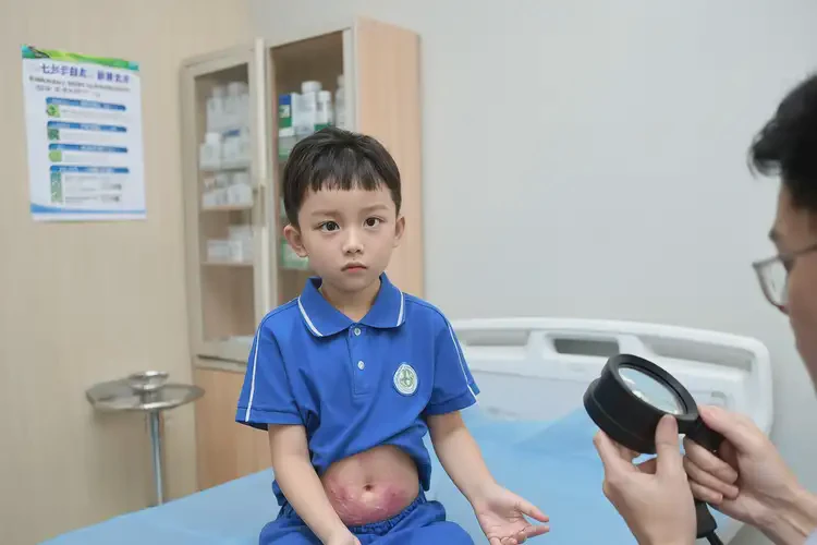 小学生肚子偶尔起湿疹能彻底自愈吗(图4)