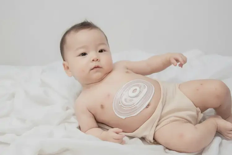 孩子肚子上偶尔长湿疹能彻底自愈吗(图2)