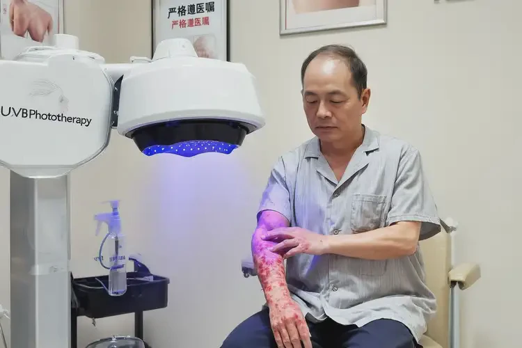 男生面部起湿疹可不可以根治(图1)