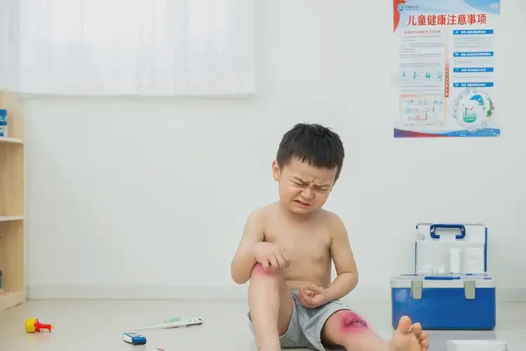 儿童大腿长湿疹不管它会自己痊愈吗(图3)