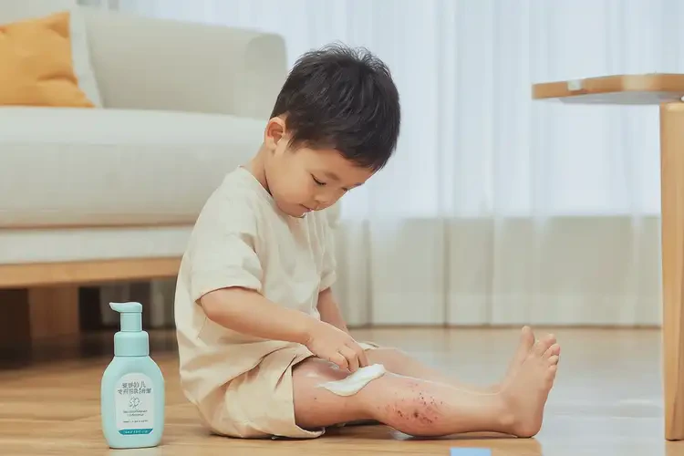 孩子大腿上容易起湿疹可不可以根治(图2)