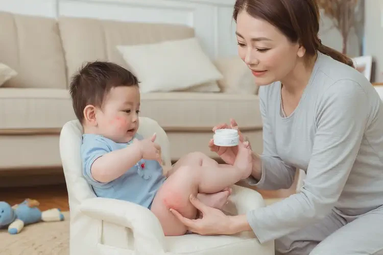 宝宝四肢偶尔起湿疹可不可以根治(图3)