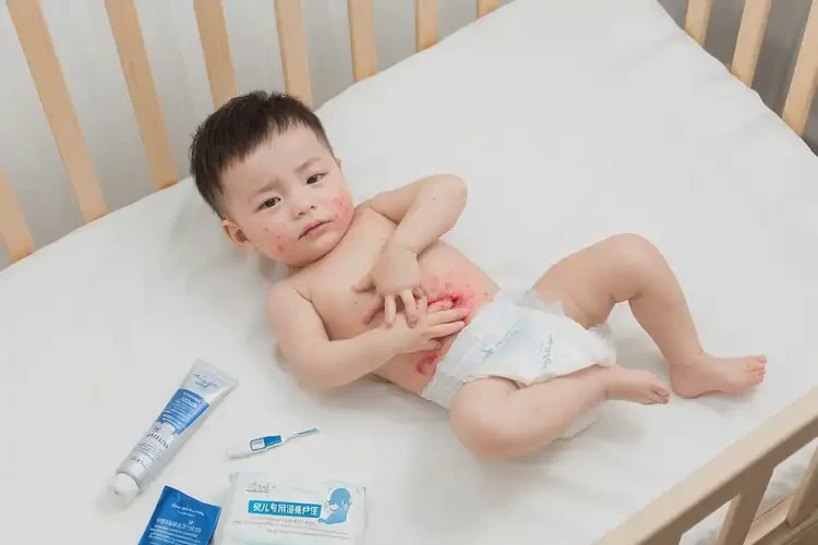 婴儿肚子出现湿疹可以治好吗(图2)