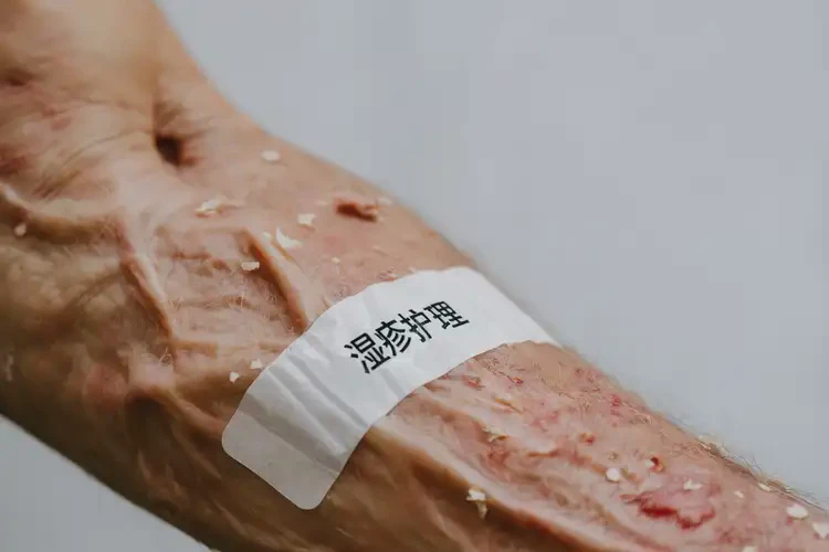 老人身上经常起湿疹可不可以根治(图4)
