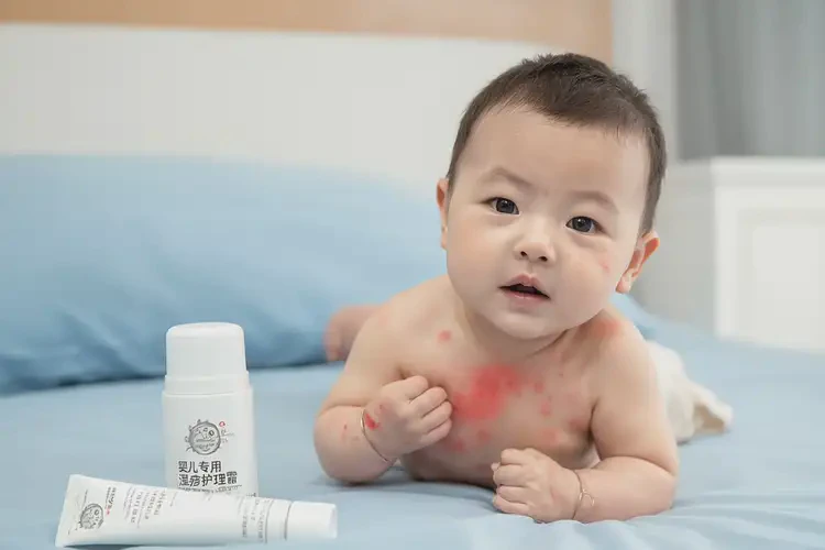宝宝肚子上经常起湿疹可不可以根治(图4)