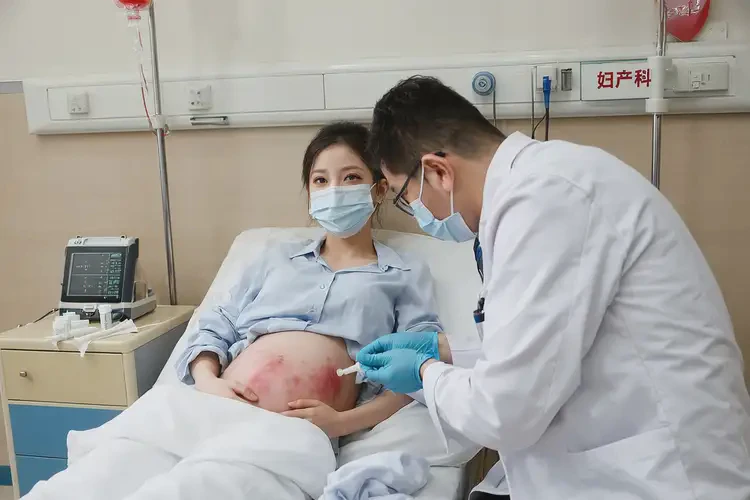 产妇肚子上长湿疹可不可以根治(图2)