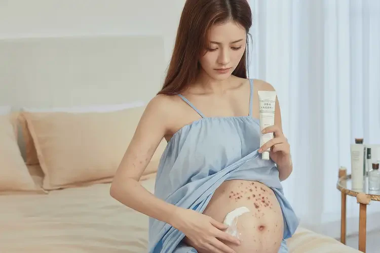 产妇肚子上长湿疹可不可以根治(图1)