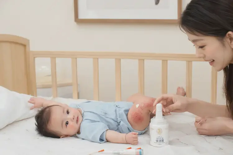 婴儿大腿上偶尔起湿疹可以治好吗(图3)
