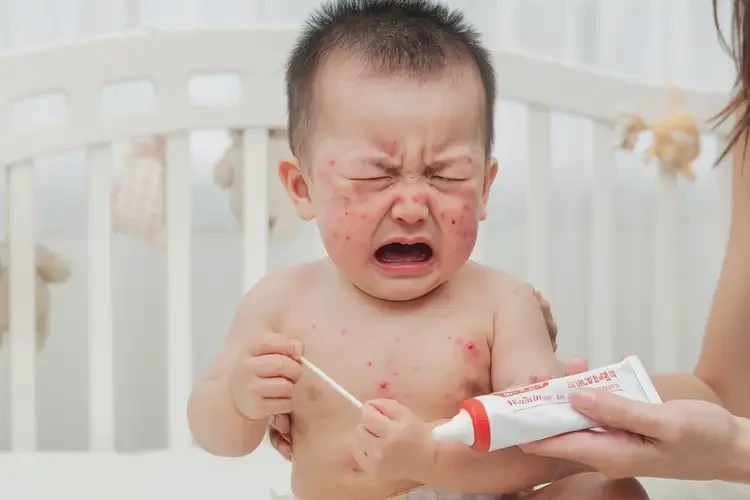 婴幼儿肛周容易长湿疹可以治好吗(图4)