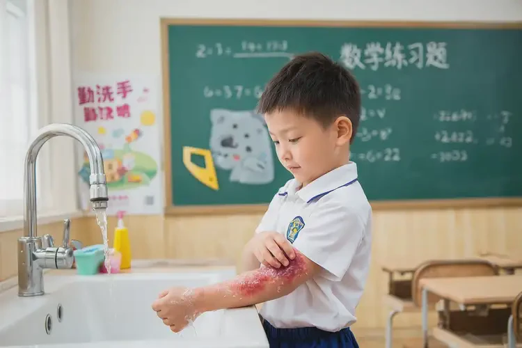 小学生手臂容易长湿疹可不可以根治(图2)