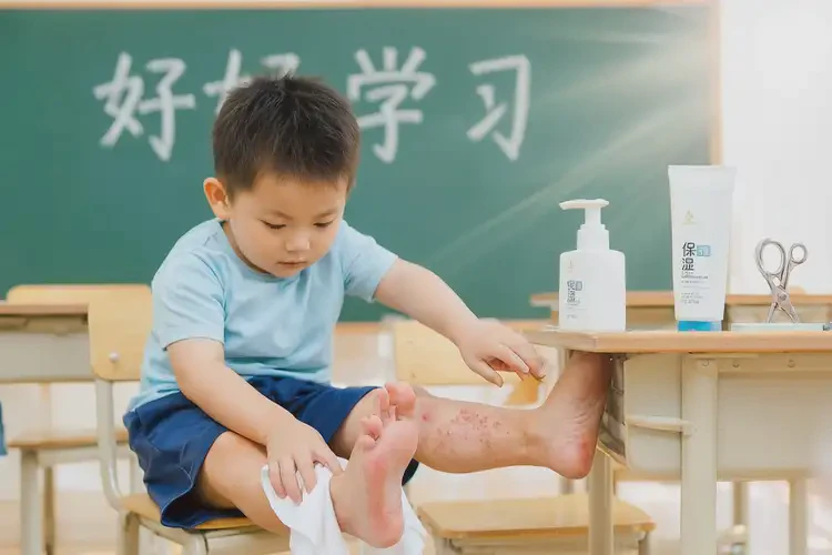 小学生脚上有湿疹可不可以根治(图1)