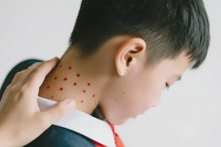 中学生脖子上经常起湿疹可不可以根治(图2)