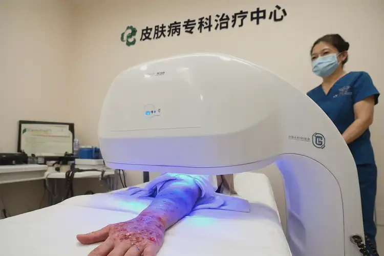 青少年手上经常起湿疹可不可以根治(图2)