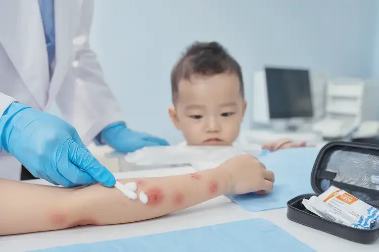 婴幼儿手臂上偶尔长湿疹可以治好吗(图3)