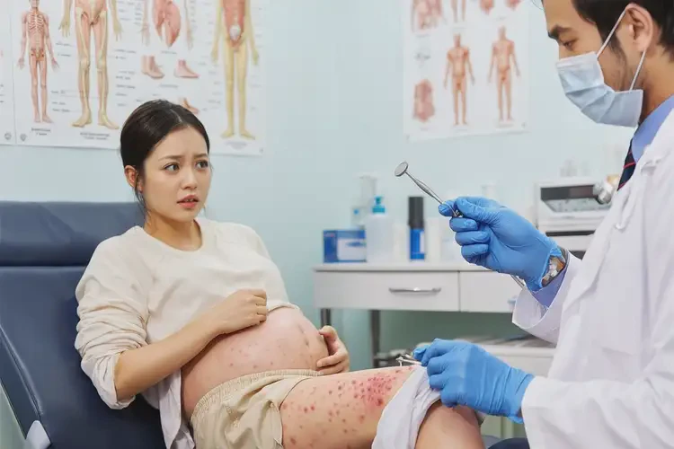孕妇小腿上经常长湿疹可不可以根治(图4)