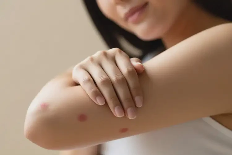孕妇手臂偶尔起湿疹可以治好吗(图4)