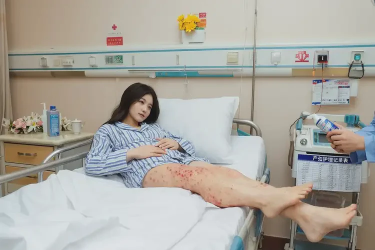 产妇小腿长湿疹可不可以根治(图1)