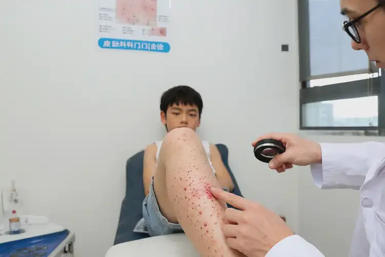 青少年小腿上偶尔长湿疹可不可以根治(图4)