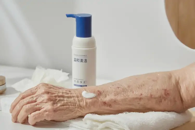 老人手臂经常长湿疹可不可以根治(图3)