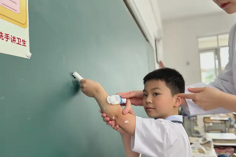 小学生手臂容易长湿疹可不可以根治(图3)