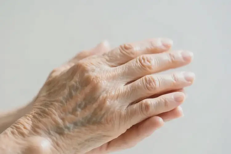 老人手上有湿疹可以治好吗(图1)
