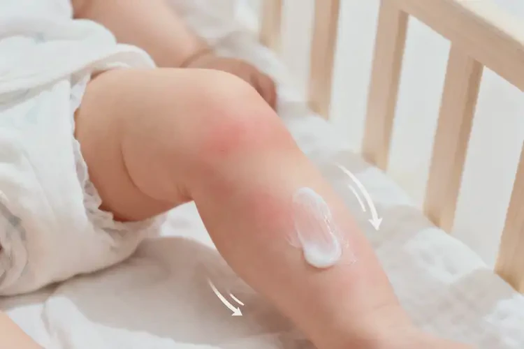 婴儿小腿上偶尔起湿疹可以治好吗(图2)