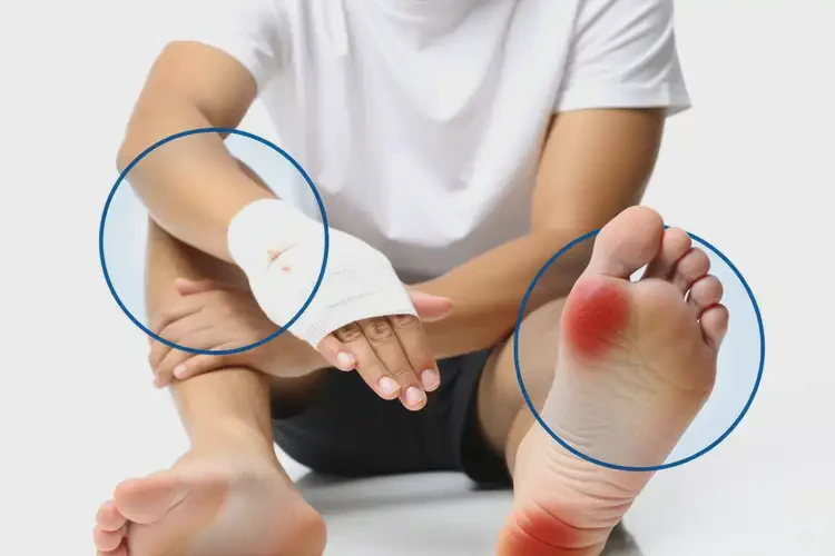 男生四肢偶尔长湿疹可以治好吗(图2)