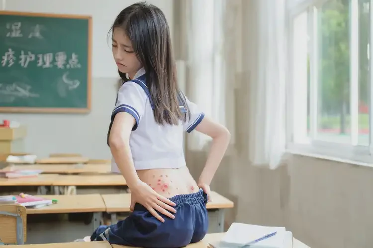 中学生屁股起湿疹可不可以根治(图4)