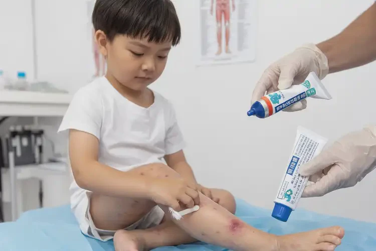 孩子小腿偶尔长湿疹可以治好吗(图4)
