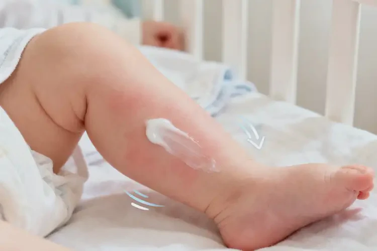 婴儿小腿上偶尔起湿疹可以治好吗(图3)