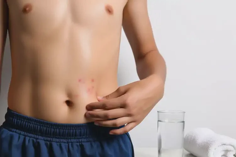 中学生肚子上偶尔长湿疹可以治好吗(图3)