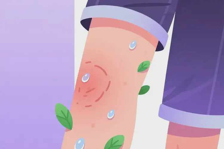 中学生大腿上偶尔起湿疹可以治好吗(图2)