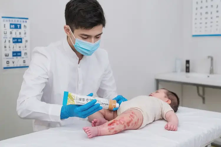 婴儿大腿经常长湿疹可以治好吗(图2)