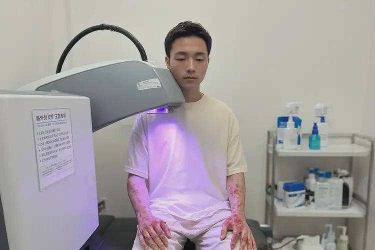 青年人大腿起湿疹可不可以根治(图1)