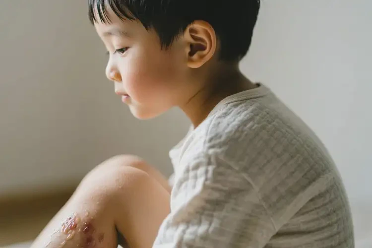 孩子全身偶尔起湿疹可以治好吗(图2)