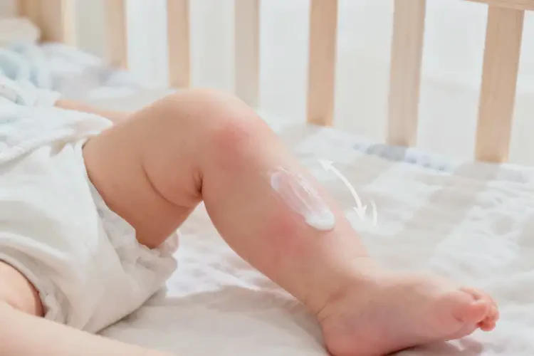 婴儿小腿上偶尔起湿疹可以治好吗(图1)