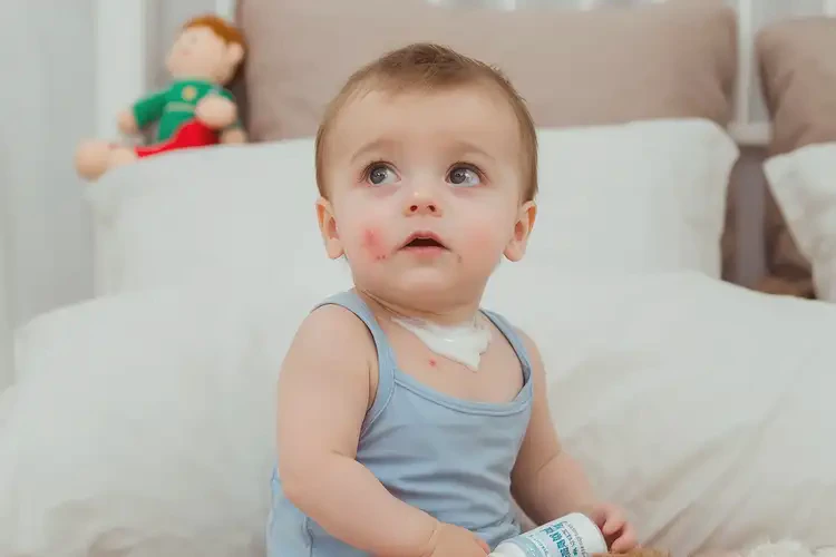 婴幼儿脖子上出湿疹可以治好吗(图3)