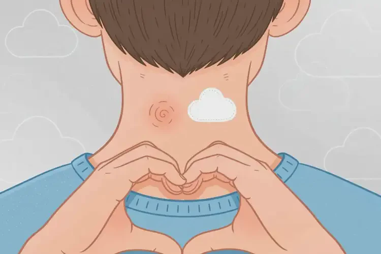男生脖子上有湿疹可以治好吗(图1)