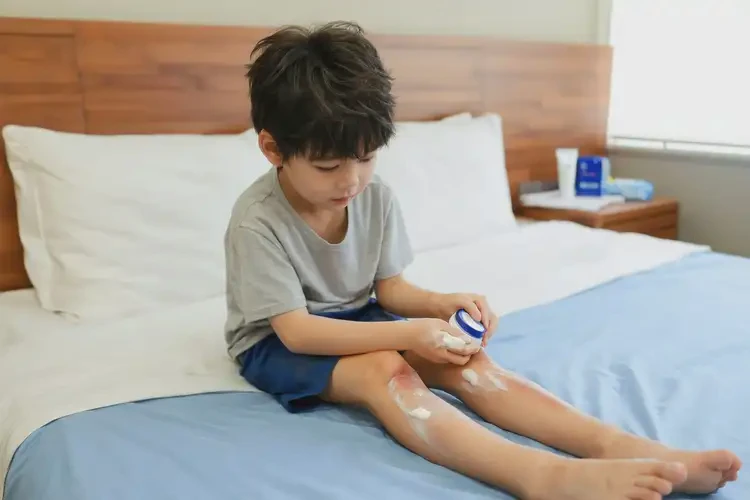 小儿大腿经常长湿疹可以治好吗(图3)