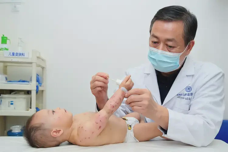 婴幼儿手臂上偶尔起湿疹可以治好吗(图3)