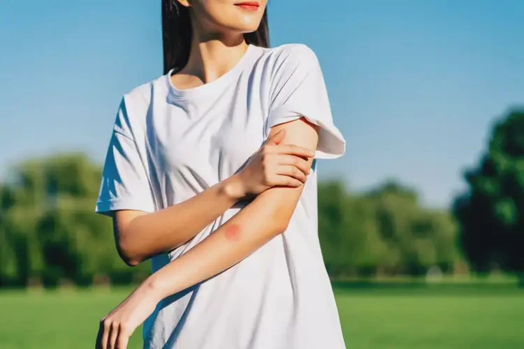 女生手臂上有湿疹可以治好吗(图2)