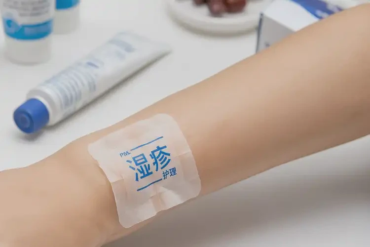 孩子身上有湿疹可以治好吗(图4)