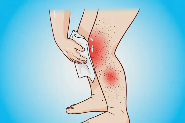 孩子大腿上经常长湿疹可以治好吗(图3)