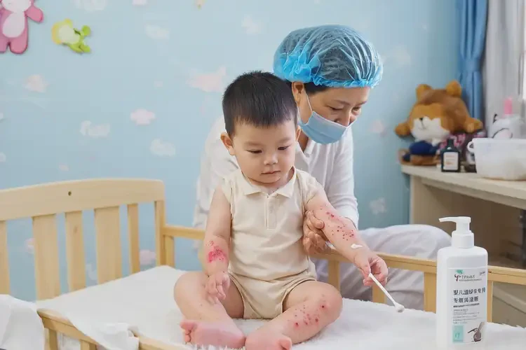 婴幼儿四肢偶尔起湿疹可以治好吗(图3)