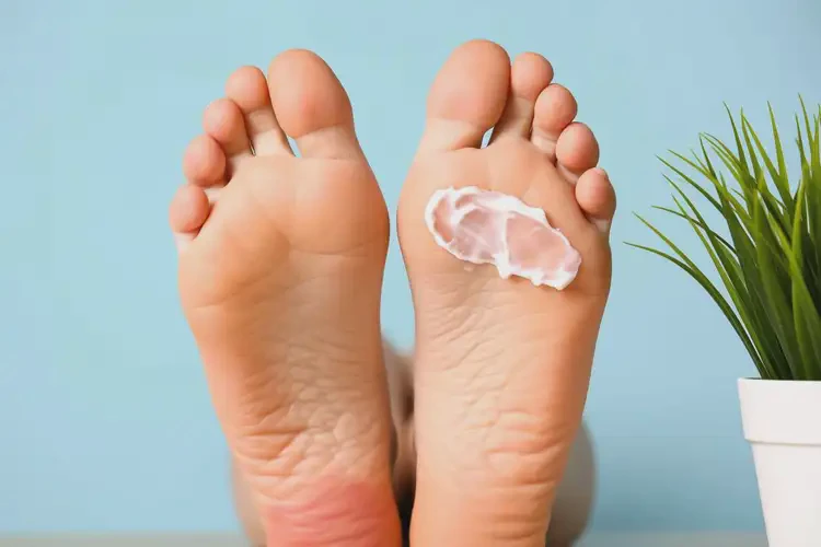 女性脚上容易起湿疹可以治好吗(图4)