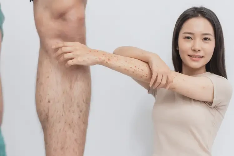 女生四肢偶尔长湿疹不管它会自己好吗(图4)
