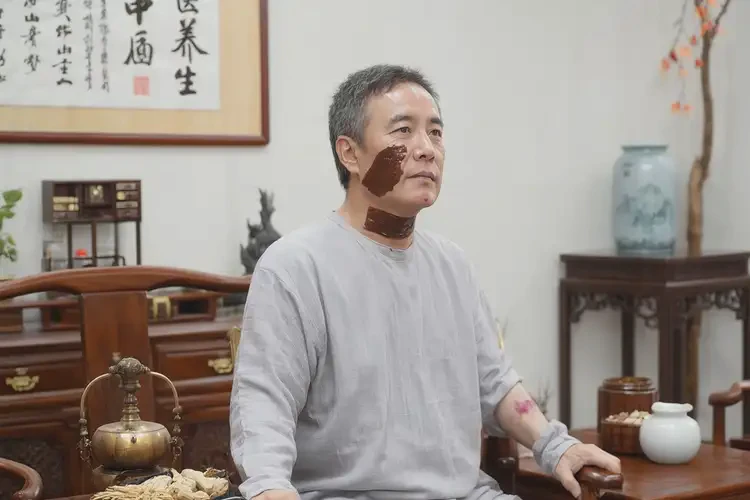 男性全身容易起湿疹可以治好吗(图3)