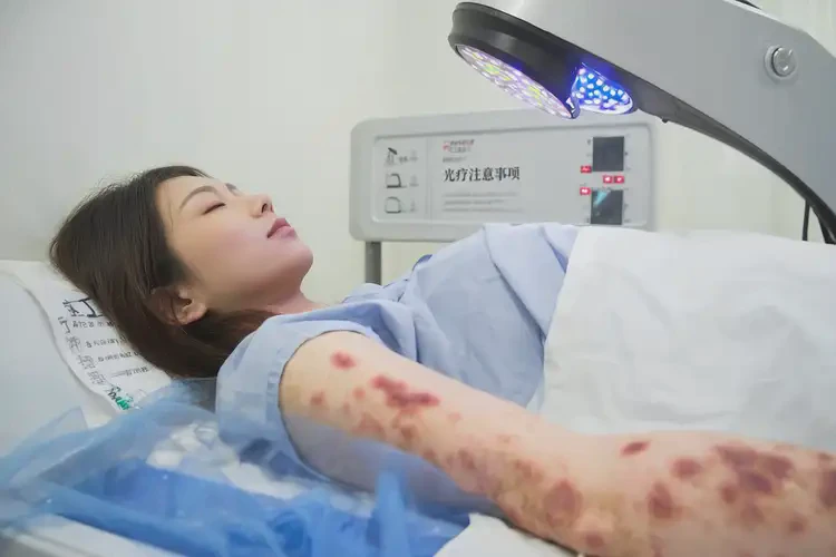 女性全身出现湿疹能够彻底治愈吗(图4)