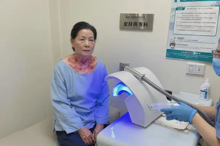 女性脖子上起湿疹可以治好吗(图2)